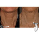 Masajeador Facial Cuello Antiarrugas✨